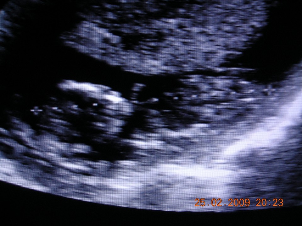 velik/a sem 5,89 cm, prehitevam za 2 dni:D